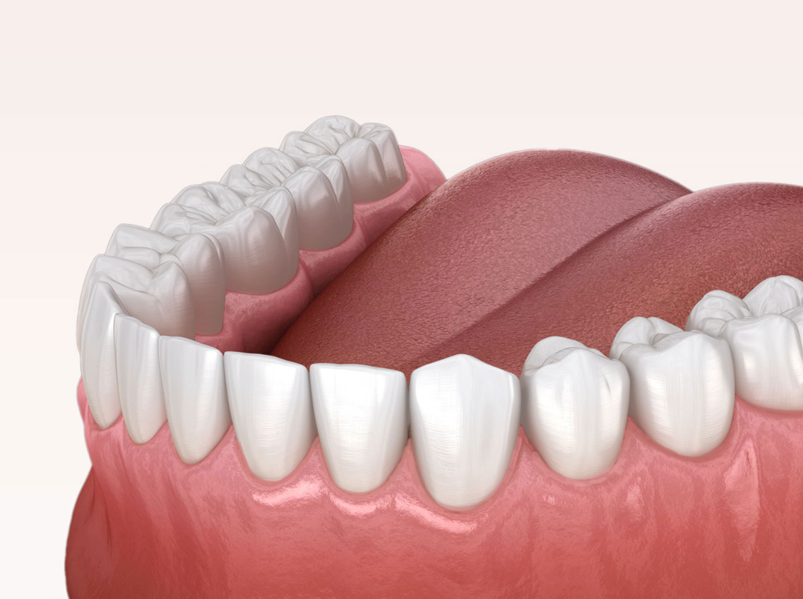 Zahnreinigung Dentalreinigung Horw